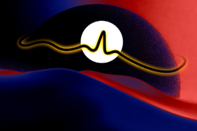 Broadcom 1,4 Trilyon Dolar Piyasa Değerine Ulaştı: AI Büyümesi Hız Kesiyor Mu?